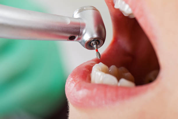 Best Broken Tooth Emergency  in Bowdon, GA